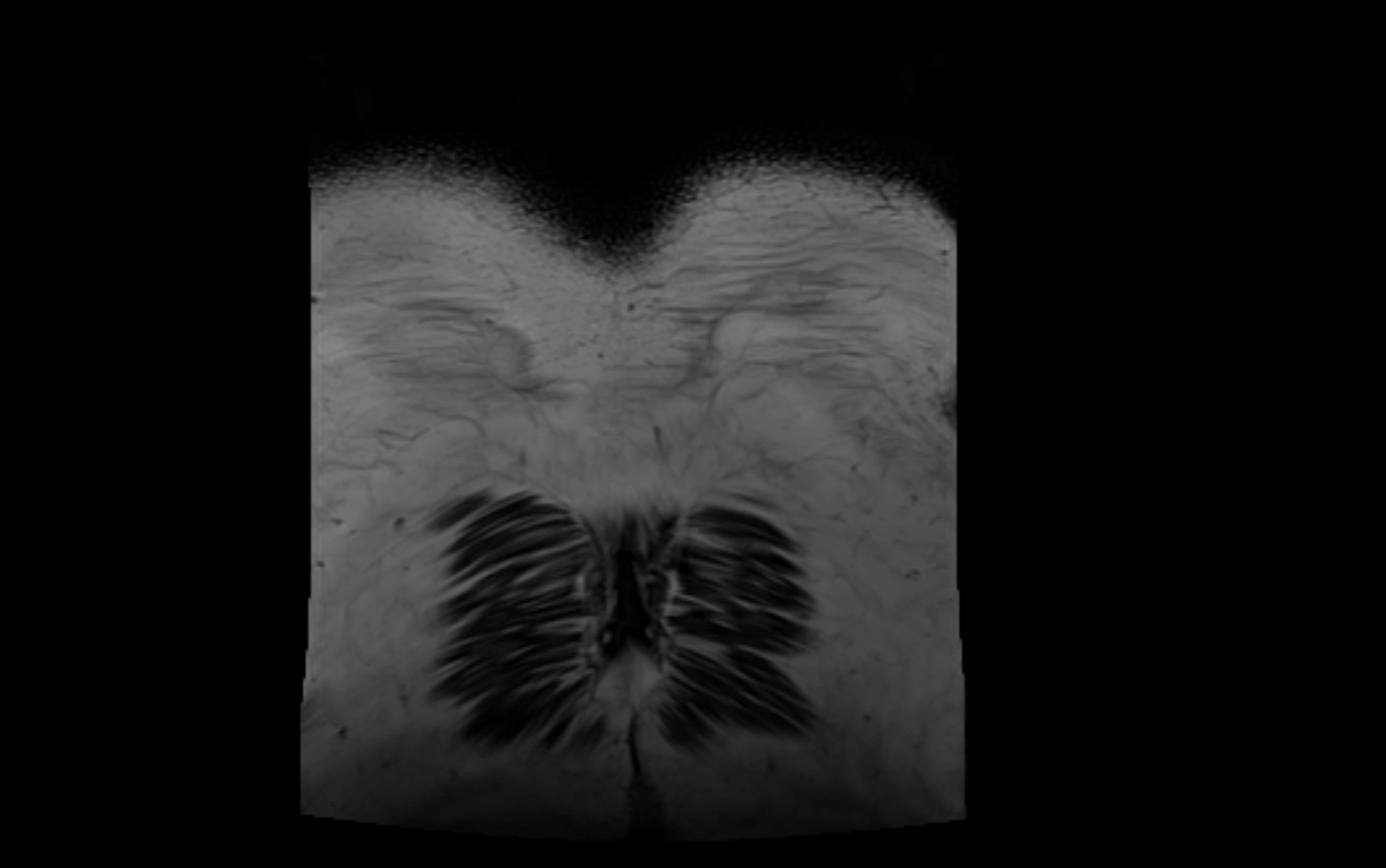 MR lumbosacral plexus cross sectional anatomy 3T  radiology  image-img-09001-00090.webp